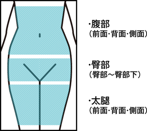 施術対象範囲：腹部（前面・背面・側面）、臀部（臀部〜臀部下）、太腿（前面・背面・側面）
